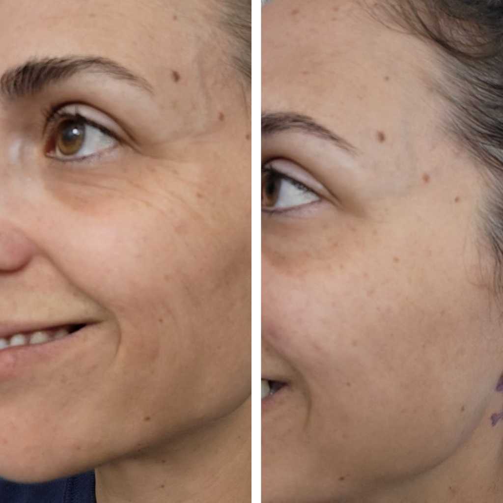 Veil of Renewal - Hydrating Lotion for Aging Skin Reducing Dark Spots, Wrinkles & Fine Lines